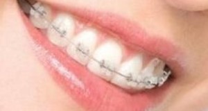 dental-06